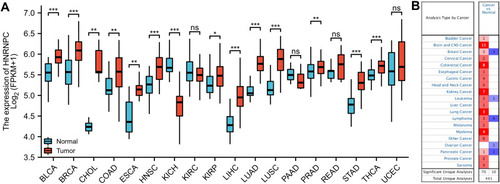 Figure 1 The expression of HNRNPC mRNA in various types of cancers. (A) TCGA database (paired samples), Wilcoxon signed-rank test. (B) ONCOMINE database, the threshold values were set as following: p-value: 0.05, fold change: 1.5, gene rank: top 10%, data type: mRNA. The graphic represents the numbers of datasets in which HNRNPC mRNA expressions were up-regulated (red) or down-regulated (blue). *p<0.05, **p<0.01, ***p<0.001.