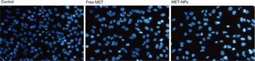 Figure 6. Morphological changes in control cells and the cells exposed to free MET and MET-loaded PLGA/PEG NPs at 48 h detected using fluorescencent microscopy.