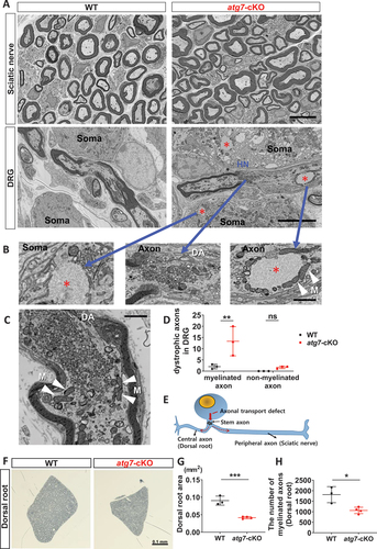 Figure 5. Neuronal subtype-specific axon degeneration was associated with proximal dystrophic axons. (A) FE-SEM images of the sciatic nerve and DRG from WT and Avil-atg7-cKO mice at postnatal week 3. Scale bar: 5 μm. *; amorphous inclusion. HN; heminode. (B) Enlargement of amorphous inclusions (asterisks) and vesicular accumulation (middle panel) within sensory neuronal soma and proximal axon. DA; dystrophic axon, M; mitochondria (white arrowheads), Scale bar: 1 μm. (C) A dystrophic proximal axon within DRG. Scale bar: 1 μm. (D) Quantification of dystrophic axons within DRG. (E) Schematic drawing of a DRG neuron with a stem axon and two axonal branches (central and peripheral). Vesicular accumulation in the stem axon near neuronal soma may break normal distal axon transport. (F). FE-SEM images of L4 dorsal roots from WT and Avil-atg7-cKO mice at adults. Scale bar: 0.1 mm. (G) Measurement of the dorsal root areas in semithin sections from WT and Avil-atg7-cKO mice. (H) Counting the number of myelinated axons in the dorsal root of WT and Avil-atg7-cKO mice. ns; non-significant, *; p < 0.05, **; p < 0.01, ***; p < 0.001.