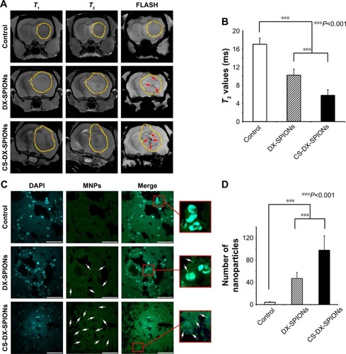 Figure 6 Targeting of the C6 glioma with CS-DX-SPIONs.Notes: (A) Magnetic resonance images of the brain tumors of the control (PBS), animals treated with DX-SPIONs and CS-DX-SPIONs. T1-weighted, T2-weighted and gradient echo (FLASH) images of the glioblastoma were obtained. Accumulation of the nanoparticles is shown by solid red arrows. (B) T2 values (ms) of the brain tumors in the control (PBS), animals treated with DX-SPIONs and CS-DX-SPIONs. Data are presented as mean ± SD. (C) Immunofluorescent images of the glioma. Nuclei stained with DAPI (blue). Nanoparticles detected using reflective laser scanning at 488 nm (green). Scale bar, 40 μm. (D) Quantification of the nanoparticles in the glioma tissue. Data are presented as mean ± SD. T1 – spin-lattice relaxation time and T2 – spin-spin relaxation time.Abbreviations: CS-DX-SPIONs, chitosan–dextran superparamagnetic iron oxide nanoparticles; DAPI, 4,6-diamidine-2-phenylindole; DX-SPIONs, dextran-coated superparamagnetic iron oxide nanoparticles; MNPs, magnetic nanoparticles; PBS, phosphate buffered saline.