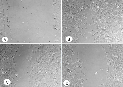 Figure 7 Scratch assay demonstrates that exposure to dextran-polyacrylamide/ZnO NPs from zinc sulphate (D-PAA/ZnO NPs(SO42-)) reduces the motility of fibroblasts at concentrations 3.07 mM and above in contrast to D-PAA/ZnO NPs(-OAc): a representative control sample directly after scratching, 0 h (A); a representative control sample, 24 h (B); a representative monolayer exposed to dextran-polyacrylamide/ZnO NPs from zinc acetate (D-PAA/ZnO NPs(-OAc)) at 12.3 mM, 24 h (C); a representative monolayer exposed to D-PAA/ZnO NPs(SO42-) at 12.3 mM, 24 h (D). Scale bar: 100 µm.