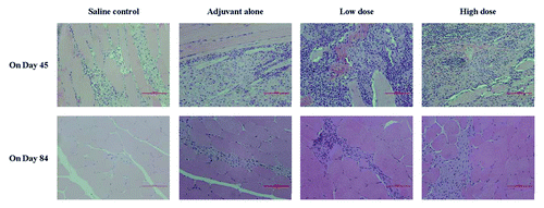 Figure 3. The histopathological changes of injection site in cynomolgus monkeys after the repeated administrations. Hematoxylin and eosin staining were performed for the slides of isolated muscle tissue from the injection sites on day 45 and 70 after the first injection.