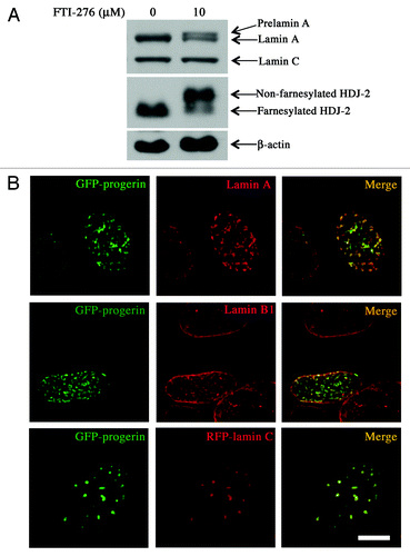 Figure 5. Effects of FTI treatment on protein farnesylation, progerin localization and intranuclear distribution of lamins. (A) FTI treatment blocks protein farnesylation in MEFs. MEFs were incubated for 48 h with 0 µM or 10 µM FTI-276 and extracted proteins were separated by SDS-PAGE and immunoblotted with antibodies against lamin A/C, HDJ-2 and β-actin. (B) Treatment of MEFs with FTI leads to intranuclear localization of GFP-progerin and altered distributions of lamin A and lamin C but not lamin B1. Confocal fluorescence micrographs showing localizations of GFP-progerin (green signals), immunofluorescence labeling with anti-lamin A antibodies (red signals, top row), immunofluorescence labeling with anti-lamin B1 antibodies (red signals, middle row) and RFP-lamin C (red signals, bottom row) in cells that were incubated with 10 µM FTI-276; merged images are shown at the right with signal overlap appearing yellow (merge). Bar: 5 µm.