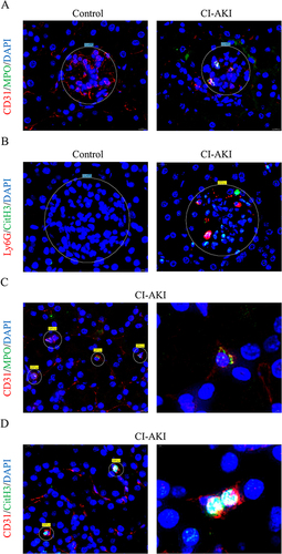 Figure 4 NETs accumulate in the glomeruli and PTC of CI-AKI mice. (A) IF co-staining: CD31, red, vascular endothelial cell marker; MPO, green, NETs marker. Magnification 1300×. (B) IF co-staining: Ly6G, red; CitH3, green. Magnification 1300×. (C and D) Neutrophil residency and NETs release in PTC. Left side magnification 1300×, right side magnification 4000×.