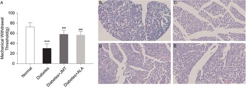 Figure 2 JMT improved mechanical allodynia and myelin sheath injury of SNs in diabetic rats.