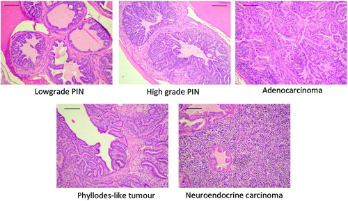 Figure 2. Histological classification of tumour lesions. Examples of the different histological types are provided. Bar =20 μm.