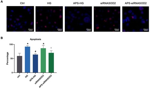 Figure 2 APS inhibited H9C2 cells apoptosis. (A) TUNEL assay microphotographs showing the apoptosis (red) cells (×400 magnification). (B) Bar graph showing the percentage of apoptosis cells in cultured cells by the TUNEL assay. Values are presented as mean ± SEM. The two-group analysis was performed using the independent samples t-test between HG and ctrl, siRNASOD2 and ctrl, APS-HG and HG, APS-siRNASOD2 and siRNASOD2. *P<0.05 vs ctrl, #P<0.05 vs HG, and !P<0.05 vs siRNASOD2, corresponding to all the repetitions in the study.