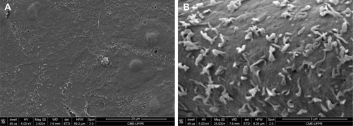 Figure S3 (A and B) Control Vero cells at 3,500× and 25,000×, respectively (SEM).Abbreviation: SEM, scanning electron microscopy.