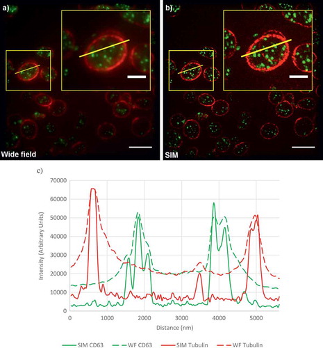 Figure 2. Comparison of diffraction-limited and super-resolution images of a platelet.(a) A wide-field image of platelets from a healthy control. Platelets are stained for tubulin (red) and CD63 (green). (b) A SIM reconstruction of the same field of view. Yellow boxes indicate the position of the enlarged inset image. (c) Line profiles of intensity, plotted for the yellow lines shown in (a,b). Note the much higher contrast and detail in the SIM images. All these images are calculated from the same data. Scale bars: main figures 5 µm; insets 2 µm. Full color available online.