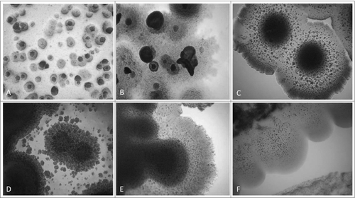 Figure 2. Development of L-form growths in semisolid agar during the second phase/week of cultivation. Light microscopy of blood isolates (No1; 34; 37, 48; 91; 96): typical “fried eggs” colonies of different size, consistence and density (A, B, C, D); formation of biofilm with gliding motility at the periphery (E, F). Magnification: 400x
