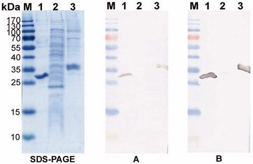 Figure 3. The reactivity of MAbs 1D8 and 3C8 with denaturated recombinant CA XII expressed in E. coli and HEK 293 cells. Left panel – SDS-PAGE; right panel – immunoblot with the MAbs 1D8 (A) and 3C8 (B). Line M, pre-stained MW markers (Thermo Fisher Scientific); line 1, purified recombinant CA XII protein expressed in E. coli; line 2, lysate of E. coli Rosetta (DE3) cells; line 3, purified recombinant CA XII expressed in HEK 293 cells.