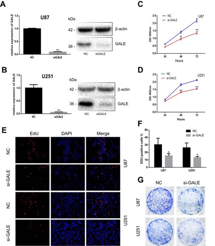 Figure 2 Silencing GALE reduces the proliferation of glioma cells. (A, B) Quantitative real-time PCR analysis showed that the relative mRNA level of GALE after si-GALE transfection was significantly decreased. GAPDH was used as the control. Western blot analysis of U87 and U251 cell lysates transfected with NC and GALE siRNAs and incubated with the GALE antibody. β-Actin was used as the control. (C, D) Growth curves of U87 and U251 cells based on the absorbance at OD450. (E, F) The transfection was followed by EdU analysis 48 h later. (G) The clonal formation of glioblastoma cells was decreased after si-GALE therapy. *P < 0.05; **P < 0.01; ***P < 0.001.