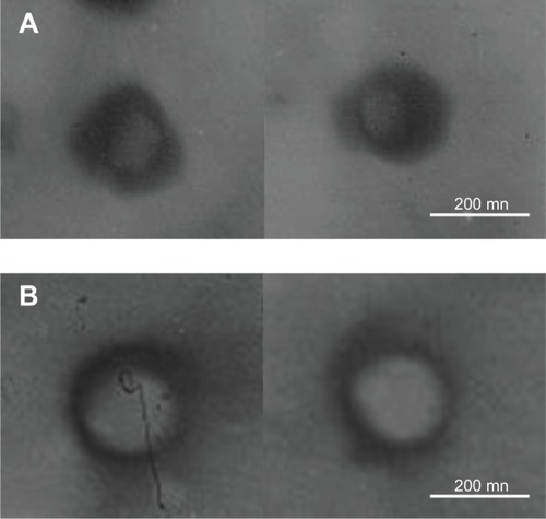 Figure 2 TEM imaging of T-SLN (A) and T-NLC (B).Notes: Both T-SLN (A) and T-NLC (B) had dark coats on the white spherical shaped particles but were slightly different in appearance.Abbreviations: DOX, doxorubicin; NLC, nanostructured lipid carrier; pEGFP, enhanced green fluorescence protein plasmid; SLN, solid lipid nanoparticle; T-NLC, transferrin-modified DOX- and pEGFP-coencapsulated NLC; T-SLN, transferrin-modified DOX- and pEGFP-coencapsulated SLN; TEM, transmission electron microscopy.