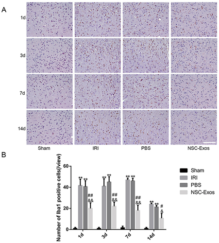 Figure 5 Immunohistochemical staining of Iba1 in the parietal cortex. (A) Iba1 staining results in each group on 1d, 3d, 7d, and 14d. MCAO rats had more various branches and hypertrophic cells, while NSC-Exos treatment decreased the number of branches and somatic cells. (B) Statistical diagram of Iba1+ cells. Microglia were activated rapidly after stroke, MCAO rats were increased Iba1+ cells, while NSC-Exos treatment significantly reduced Iba1+ cells (**P<0.01 vs Sham group; ##P<0.01, #P<0.05 vs IRI group; &&P<0.01, &P<0.05 vs PBS group, Scale bar=20μm).