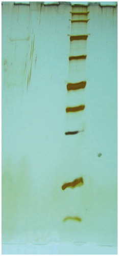 Figure 2. SDS-PAGE bands of DPD enzyme from sheep liver. Gel stained using the silver staining procedure. Lane 1: affinity chromatograph; lane 2: standard proteins (SDS-PAGE: sodium dodecyl sulphate polyacrylamide gel electrophoresis, DPD: dihydropyrimidine dehydrogenase enzyme).
