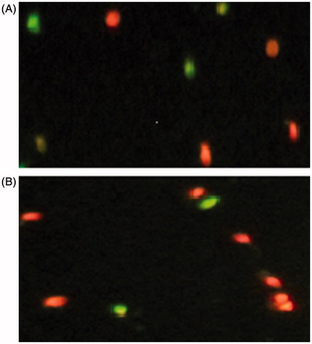 Figure 1. Determination of DNA fragmentation in the thawed sperm of control group (A), no addition of butylated hydroxytoluene) and in the thawed sperm incubated 5 minutes with 0.5 mM butylated hydroxytoluene (B) using the TUNEL test. Spermatozoa with fragmented DNA were visualized using fluorescence microscope in excitation wavelength 488 nm and detection in the 540 nm. The spermatozoa with DNA fragmentation are shown in green and spermatozoa having intact DNA are shown in red.