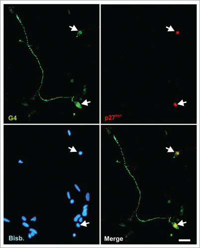 Figure 3. p27Kip1 is expressed by RGCs in vitro. E6 chick retinal cells were cultured under neurogenic conditions for 20 h, fixed and immunostained with antibodies against G4 (green) and p27Kip1 (red). Only differentiated RGCs neurons (G4+ cells) express p27Kip1. Nuclear staining with bisbenzimide (Bisb.) is shown in blue. Bar: 20 μm.