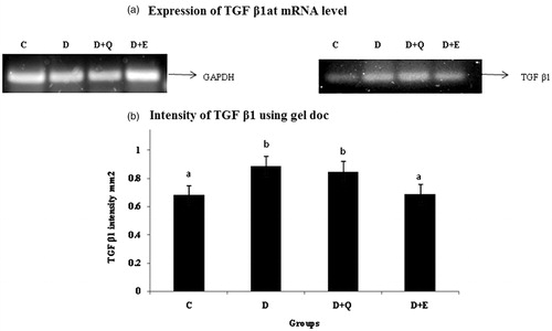 Figure 5. The relative amount of TGF-β1 mRNA was estimated by semi-quantitative RT-PCR. The PCR products were quantified by densitometry and standardized to their respective GAPDH controls. The mean intensity was measured and expressed as INT/mm2. Results are expressed as average of quadruplicate experiments ± SD statistically significant p ≤ 0.05.