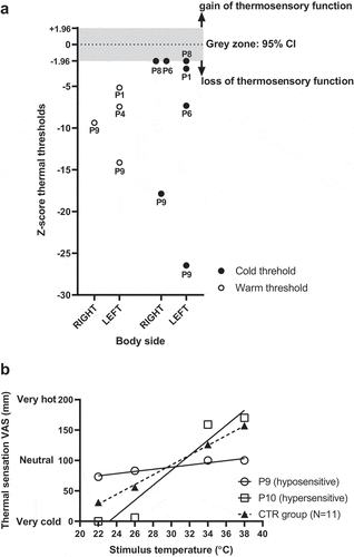 Figure 1. (a) Individual threshold z scores for both cold and warm temperatures and on the left and right side of the body for the 5 MS patients (i.e. P1,4,6,8,9) exhibiting thermosensory abnormalities. Patient number is reported for each value. The gray zone corresponds to the 95% CI of the CTR group, hence values above or below this band indicate a gain or a loss of function, respectively. (b) Thermosensitivity regression lines for the association between stimuli temperature and magnitude estimation, for the CTR group (N = 11) and for the 2 MS patients who exhibited abnormal sensitivity (i.e. slope z score beyond ±1.96 standard deviation of the CTR group)