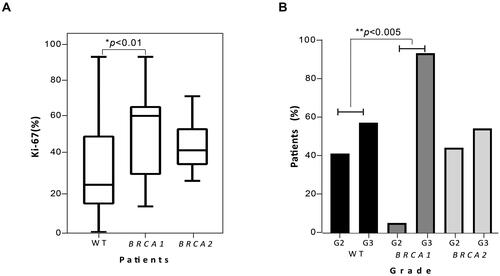 Figure 5 Correlation of Ki-67 and grading distribution in breast cancer women with or without BRCA1 and BRCA2 PVs. (A) Boxplots show comparison of median Ki-67 among 181 non-carriers BC patients and those with BRCA1 (18) or BRCA2 (17) PVs. P value below 0.5 was considered statistically significant. (B) The histograms represent the distribution of BC cancer patients into the histological grade group (G2 and G3) according to the BRCA1 and BRCA2 mutational status (WT subjects, BRCA1 and BRCA2 PVs carriers).