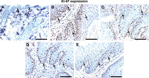 Figure 4 Effect of Leiurus quinquestriatus venom extract on cell proliferation marker Ki-67 in the chemically induced skin tumors.