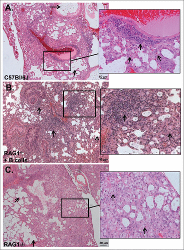 Figure 6. Inflammatory patterns (H&E) of C. neoformans-infected C57Bl/6 (wild-type), Rag1−/− mice that received (B)cells and Rag1−/− mice, 14 d post-infection. A) Wild-type mice. Arrows point to large collections of extracelluar organisms in airspaces. Inset: Organized granulomatous inflammation composed of polymorphonuclear leukocytes, lymphocytes, epithelioid cells and macrophages. Inset: arrows point to lymphocytes and macrophages associated with perivascular inflammation. Five mice were examined. (B) Rag1−/− mice that received peritoneal B cells. Arrows point to organized granulomatous inflammation composed of lymphocytes, polymorphonuclear leukocytes and macrophages associated with perivascular inflammation. There are also large collections of organisms in airspaces. Inset: arrows pointing to lymphocytes and macrophages in cellular infiltrate.  Two mice were examined. (C) Rag1−/− mice. Arrows point to large collections of extracellular organisms in airspaces. Inset: Inflammatory cells are polymorphonuclear leukocytes, epitheloid cells and macrophages as shown by arrows. Five mice were examined. Scale bar = 50 um.