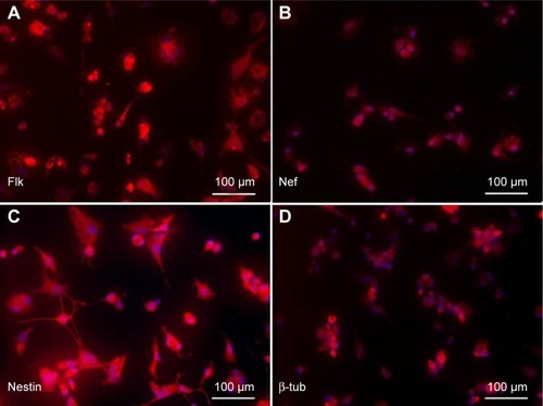 Figure 8 Immunostaining of BM-MSCs differentiated to neurons after β-mercaptoethanol (BME) treatment.