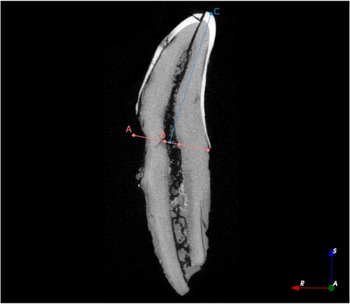 Figure 1. Measurements for crown height on canines, shown as A) tooth width at CEJ; B) total pulp cavity width; and C) crown height.