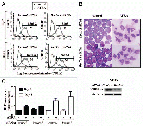 Figure 3 Effect of silencing BECN1 expression on granulocyte differentiation in APL cells. (A–C) NB4 cells were transfected with control or BECN1-specific siRNAs, and then treated with ATRA (1 µM) for the times indicated. Granulocytic differentiation was assessed by: (A), measuring CD11c expression by FACS after 3 and 4 d of ATRA treatment; M is the percentage of cells expressing high levels of CD11c. (B) May-Grunwald Giemsa staining after 4 d of ATRA treatment; inset, the levels of Beclin 1 protein expression in ATRA-treated NB4 cells in the presence and absence of BECN1 siRNA are shown. (C) Quantification of anion superoxide production by using dihydroethidium (HE) dye in NB4 cells treated with ATRA for 2 or 3 d. Results are expressed as the ratio of the population of cells with high HE staining in ATRA-treated cells to the population of cells with high HE in control cells.