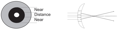 Figure 2 Diagram of a concentric SCL. In this design, distant and near vision are provided by concentric areas of the CL, which are classified as bifocal and progressive multifocal.