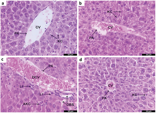 Figure 6. Histopathological examination of mice liver sections. a: liver of control mice without fasting, b: liver sections of non-diabetic mice with fasting, c: liver sections of diabetic mice without fasting, d: liver sections of diabetic mice with fasting.