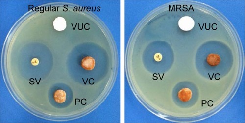 Figure 3 Whether on regular S. aureus or MRSA, VC subgroup both showed strongest antibacterial activity.Abbreviations: MRSA, methicillin-resistant Staphylococcus aureus; VUC, bone-like hydroxyapatite/poly amino acid group; PC, vancomycin-loaded polymethyl meth acrylate group; SV, standard vancomycin; VC, vancomycin-loaded bone-like hydroxyapatite/poly amino acid group.
