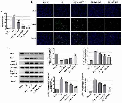 Figure 3. CAR suppressed the apoptosis level in HG-induced ARPE-19 cells. (A&B). Detection of apoptosis in cells induced by HG was carried out by TUNEL after CAR treatment. (c). The expression levels of apoptosis-related proteins Bcl-2, Bax, cleaved-caspase3 and cleaved-caspase9 in cells induced by HG were detected by Western blotting after CAR treatment. Data are expressed as mean ± SD. ***P < 0.001 versus control. #P < 0.05, ###P < 0.001 versus HG.