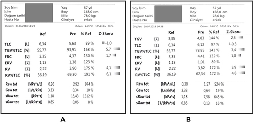 Figure 2 A Body plethysmography data samples of a 57-year-old male patient with a history of smoking 60 pk/year, who has attended sixteen sessions (8 weeks) of PR program; before attending (A) and after attending (B).