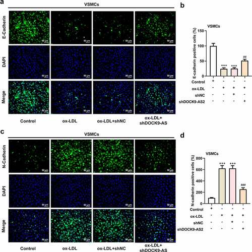 Figure 1. The effect of ox-LDL and DOCK9-AS2 knockdown on the proliferation and migration of VSMCs. (Figure 1a. A) VSMCs were treated with ox-LDL and transfected with shNC or shDOCK9-AS2, and the relative mRNA level of DOCK9-AS2 in VSMCs was detected using qRT-PCR. (Figure 1a. B) The OD value at 450 nm was detected by CCK-8 assay. (Figure 1a. C-D) The expression of Ki67 was assessed by immunofluorescent staining. nuclei were stained with DAPI (blue); Magnification, x200. (Figure 1a. E-F) Cell migration ability was analyzed by Transwell assay. (Figure 1b. A-D) The protein expression of E-Cadherin and N-Cadherin was measured by immunofluorescent staining (nuclei were stained with DAPI; Magnification, x200). *** P < 0.001 vs. the control group; ## P < 0.01, ### P < 0.001 vs. the ox-LDL group.