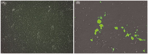Figure 6. GFP expression for nanoplexes prepared in 150 mM saline with polymer to plasmid weight ratio of 10 (A) and 12 (B) in NT8e cells after 48 h by fluorescence microscopy; (A) is cells treated only with 150 mM saline.