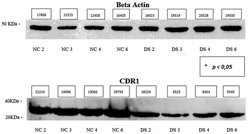 Figure 3. Western blot of 4 normal fibroblast cell line (Control) and 4 DS cell line (Down), CDR1 protein approximately 30–35 kDa, β-Actin protein approximately 45 kDa. Densitometric value (pixels) of bands and p value * calculated by inferential statistical analysis are present in the figure.