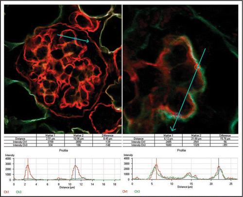 Figure 11 To evaluate the relative contribution of endothelial cells to developing GBMs, immunofluorescence signal strengths across GBMs were quantified from host glomeruli (A) and compared with those from hybrid glomeruli (B) in adjacent areas containing metanephric grafts. Histogram plots show peak intensity values for laminin α5 chain (red) at bisected regions of the GBM. Only background levels for laminin α1 chain (green) are observed at these same points in normal glomeruli (A), whereas hybrids show abnormally high levels of α1 in outer layer of GBMs (B). Reproduced with permission (ref. Citation100).