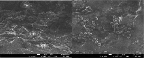 Figure 5. (a), (b). Scanning electron microscopic image showing biofilm of S. aureus.