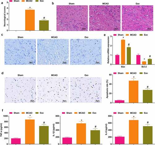 Figure 2. Exosomes can effectively mitigate cerebral I/R injury. A, the neurological function score of MCAO rats after injection with exosomes; B, pathological tissue damage in rat brain after injection with exosomes was detected by HE staining (scale bar = 50 μm); C, the pathological damage in rat brain (scale bar = 50 μm) after injection with exosomes was examined by Nissl staining; D, cell apoptosis in rat brain after injection with exosomes was assessed by TUNEL staining (scale bar = 50 μm); E, Bax and Bcl-2 mRNA levels in rat brain after injection with exosomes were examined by RT-qPCR; F, the levels of inflammatory factors (TNF-α, IL-1β, IL-6) in rat brain was after injection with exosomes were detected by ELISA; A-F, n = 6; * P < 0.05 vs. the Sham group; # P < 0.05 vs. the MCAO group; the data were expressed as mean ± standard deviation; one-way ANOVA was used for comparisons among multiple groups and Tukey’s post hoc test was used for pairwise comparisons.