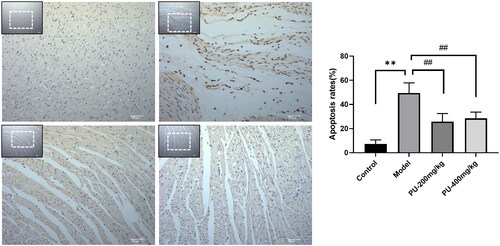 Figure 5. Punicalagin reduced cardiomyocyte apoptosis via TUNEL staining. The values are expressed as mean ± SD (n = 10). **p < 0.01 vs. Sham group; ##p < 0.01 vs. model group.