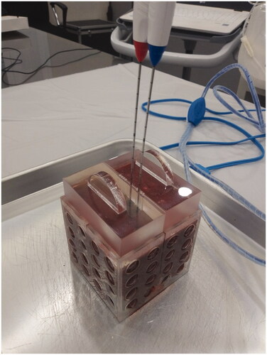 Figure 2. Radiofrequency ablation settings. Explanted bovine livers were sliced into blocks in order to fit in a cube of 8 × 8 × 8 cm3. After placing the liver block into the cube, an acrylic plate was placed on top of the cube. The acrylic plate has multiple holes at 5-mm intervals at the midline of the cube, and through the holes the electrodes are inserted. The electrodes were inserted at a 1-cm inter-electrode distance.
