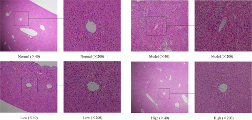 Figure 4 Effects of Lactobacillus plantarum KSFY06 on the liver morphology of injured mice. Model: group induced by D-Gal/LPS (250 mg/kg·bw, 25 mg/kg·bw); Low: treated with LP-KSFY06 (2.5×109 CFU/kg·bw); High: treated with LP-KSFY06 (2.5×1010 CFU/kg·bw).