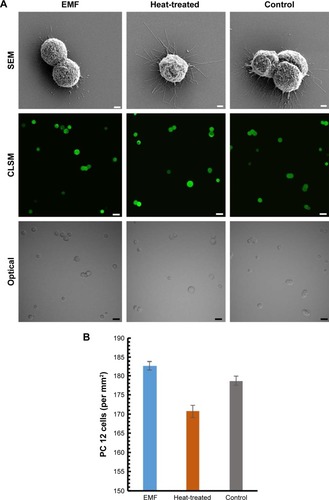 Figure 5 Morphology and viability of PC 12 cells after exposure to EMF radiation.Notes: (A) Scanning electron micrographs (top row) of PC 12 cells after being exposed to EMF radiation. No significant changes in cell morphology were detected in the EMF-treated groups in comparison to the heat-treated and control samples. Scale bar: 2 µm. CLSM images (middle row) indicated cell viability, PC 12 cells exposed to EMF, heat treatments, and the control all remained viable. Phase contrast (bottom row, optical) images of the same field of view. Scale bar: 5 µm. (B) Quantification of viable PC 12 cells after exposure to EMF radiation. The number of viable cells in the EMF-treated and the other control groups varied slightly; no significant changes (P>0.05) were detected. Data are presented as mean ± SD and are representative of three independent repeat experiments.Abbreviations: EMF, electromagnetic field; SEM, scanning electron microscopy; CLSM, confocal laser scanning microscopy.