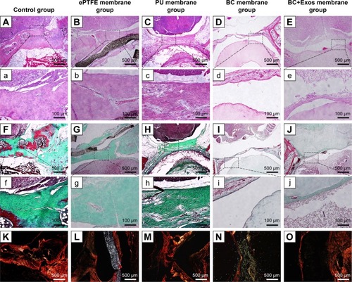 Figure 7 Histological examination.Notes: (A, a, B, b, C, c, D, d, E, and e) The HE staining images of the control, ePTFE membrane, PU membrane, BC membrane, and BC+Exos membrane groups at 1 year post operation, respectively. (F, f, G, g, H, h, I, i, J, and j) The Masson trichrome images of the control, ePTFE membrane, PU membrane, BC membrane, and BC+Exos membrane groups at 1 year post operation, respectively. (K–O) The Sirius red staining of the control, ePTFE membrane, PU membrane, BC membrane, and BC+Exos membrane groups at 1 year post operation, respectively.Abbreviations: BC, bacterial cellulose; BC+Exos, bacterial cellulose combined with exosomes; ePTFE, expanded polytetrafluoroethylene; MRI, magnetic resonance image; PU, polyurethane.