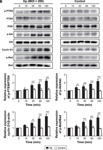 Figure 6 Helicobacter pylori infection induces PLK1-mediated activation of the PI3K/Akt pathway in a time-dependent manner. Cultures of MKN-28 cells were incubated at different time points with H. pylori infection (MOI = 200). Immunoblotting was used to quantify the expression levels of PLK1 (A) and Akt pathway-related proteins (B). The data are representative of three independent experiments. The samples were derived from the same experiment and the blots were processed in parallel. **p<0.01; ***p<0.001.