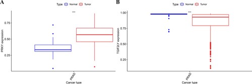 Figure 1. Bioinformatics analysis of PRKY and TGIF2LY expression in prostate cancer. The expression of PRKY was high in cancer tissues and low in normal tissues, and the difference was statistically significant (P < 0.001, Figure 1(A)). The expression of TGIF2LY in prostate cancer tissues was significantly lower than that in normal tissues (P < 0.001, Figure 1(B)).