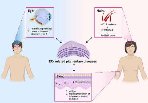 Figure 2 Pigmentary diseases related to ER homeostasis. Dysfunction of ER is associated with multiple diseases. Pigmentary disorders can manifest as abnormal pigmentation of the skin, eyes, and hair. These different kind of pigmentary diseases which are potentially relevant to ER dysfunction are listed.