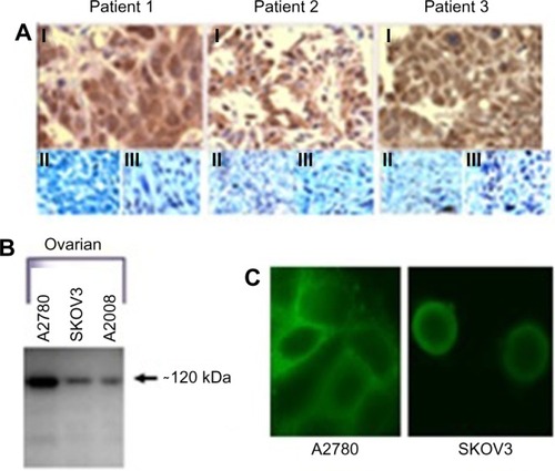 Figure 1 Antibody Staining for presence of NMDA Receptors.