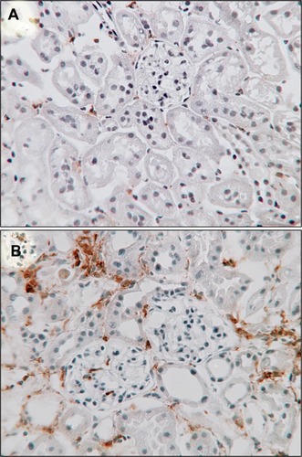 Figure 3 Macrophages in diabetic nephropathy.